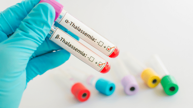 All you need to know about Thalassemia