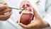 Kidney Health: Warning signs that mimic other conditions