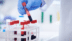 Alzheimer's disease: A blood test can detect early symptoms, finds study