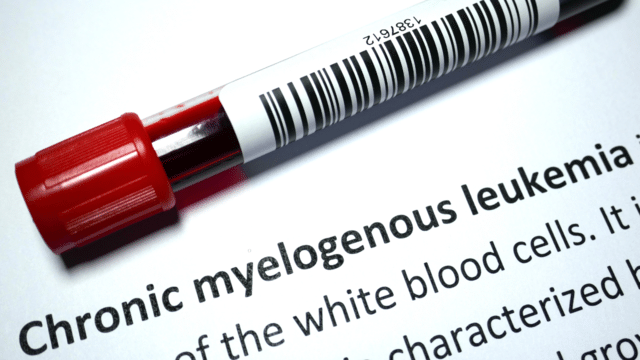 6 key questions to ask your doctor about Chronic Myeloid Leukemia