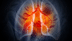 7 early warnings signs of lung cancer to keep an eye on
